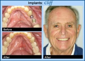 Happy patient after restoring oral health in Chicago IL