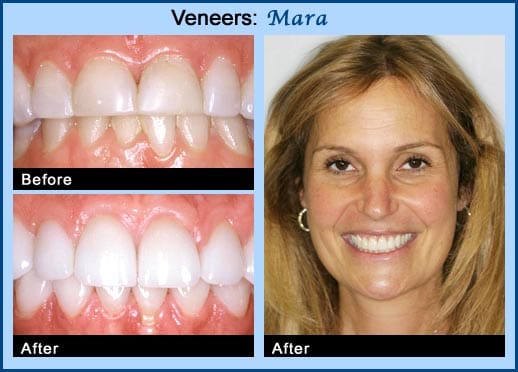 Before and after cosmetic dental services at North Dental Professionals