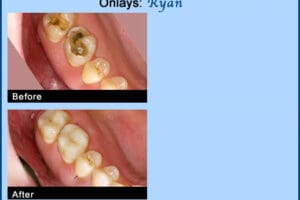 Main Gallery Image 5 | Smile Gallery